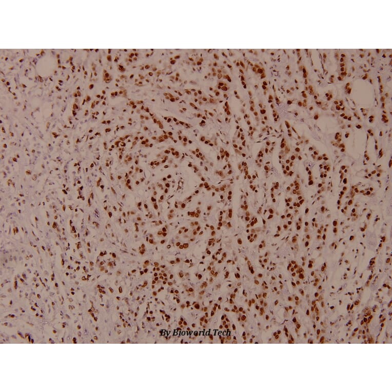 Anti-Stat5 (phospho-S726/731) Antibody from Bioworld Technology (BS4464) - Antibodies.com