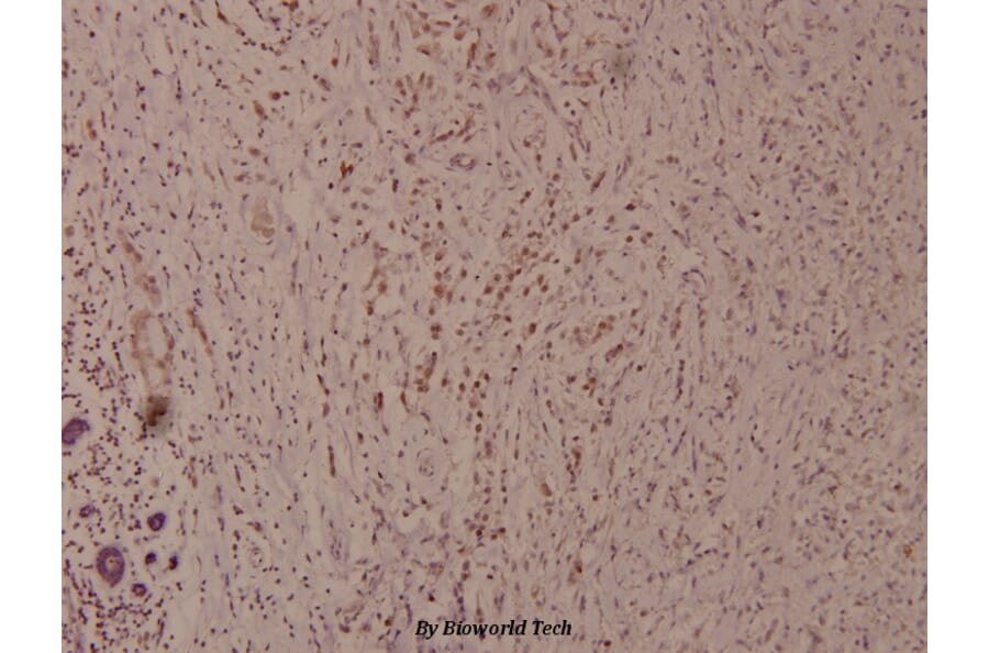 Anti-Bad (phospho-S91) Antibody from Bioworld Technology (BS4474) - Antibodies.com