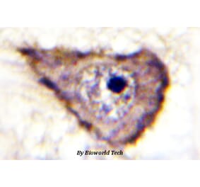 Anti-VEGFR1/Flt-1 (phospho-Y1333) Antibody from Bioworld Technology (BS4538) - Antibodies.com