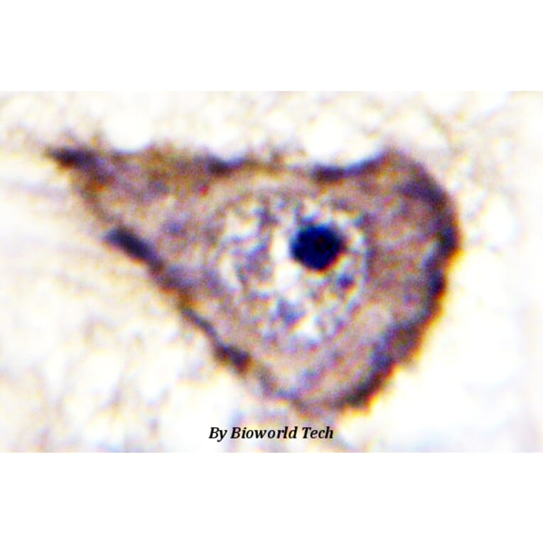 Anti-VEGFR1/Flt-1 (phospho-Y1333) Antibody from Bioworld Technology (BS4538) - Antibodies.com