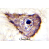 Anti-VEGFR1/Flt-1 (phospho-Y1333) Antibody from Bioworld Technology (BS4538) - Antibodies.com