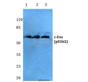 Anti-c-Fos (phospho-S362) Antibody from Bioworld Technology (BS4540) - Antibodies.com