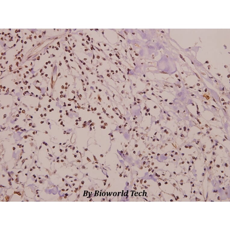 Anti-Smad1 (phospho-S465) Antibody from Bioworld Technology (BS4573) - Antibodies.com