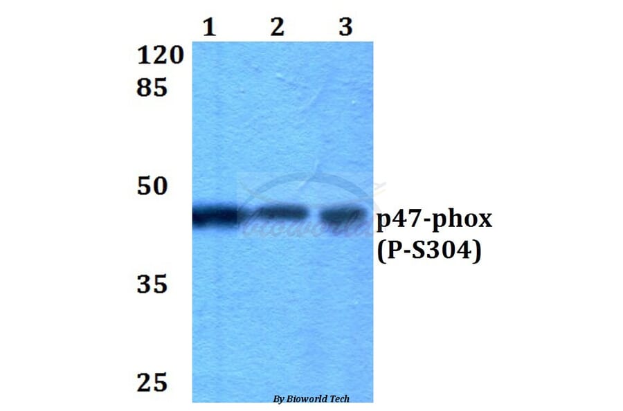 Anti-p47-phox (phospho-S304) Antibody from Bioworld Technology (BS4600) - Antibodies.com