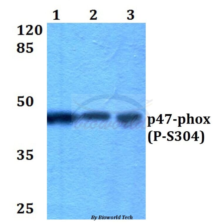 Anti-p47-phox (phospho-S304) Antibody from Bioworld Technology (BS4600) - Antibodies.com