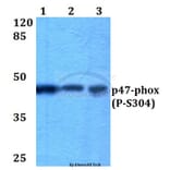 Anti-p47-phox (phospho-S304) Antibody from Bioworld Technology (BS4600) - Antibodies.com