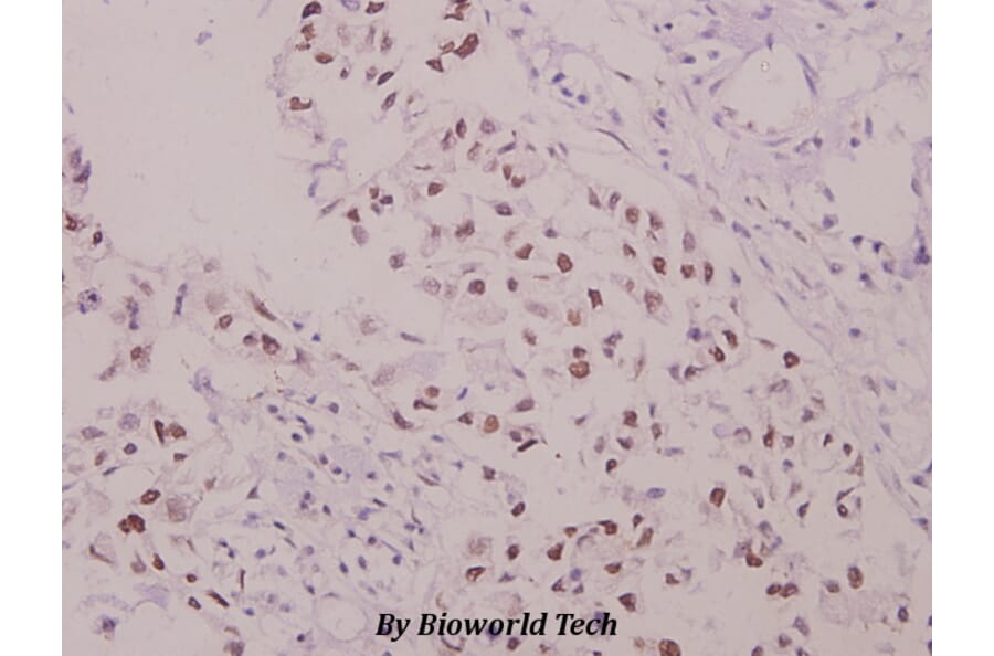 Anti-p47-phox (phospho-S304) Antibody from Bioworld Technology (BS4600) - Antibodies.com