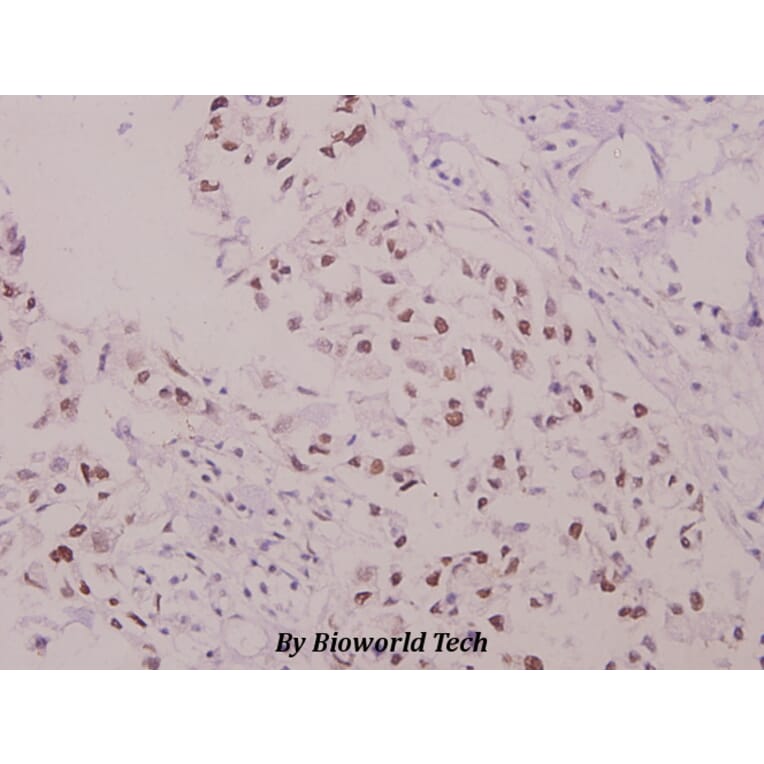 Anti-p47-phox (phospho-S304) Antibody from Bioworld Technology (BS4600) - Antibodies.com