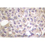Anti-PI3K p85α/p55γ Antibody from Bioworld Technology (BS4605) - Antibodies.com