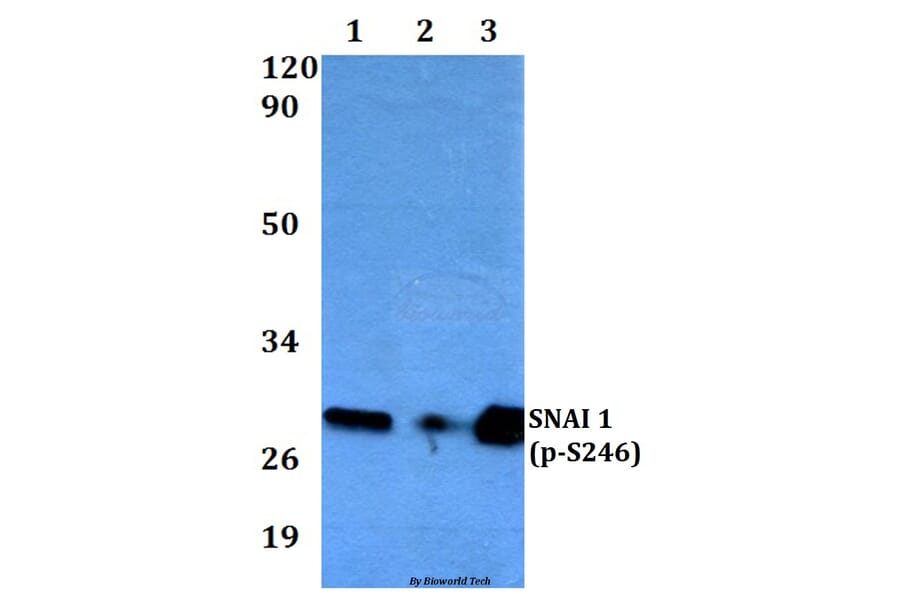 Anti-SNAI 1 (phospho-S246) Antibody from Bioworld Technology (BS4606) - Antibodies.com