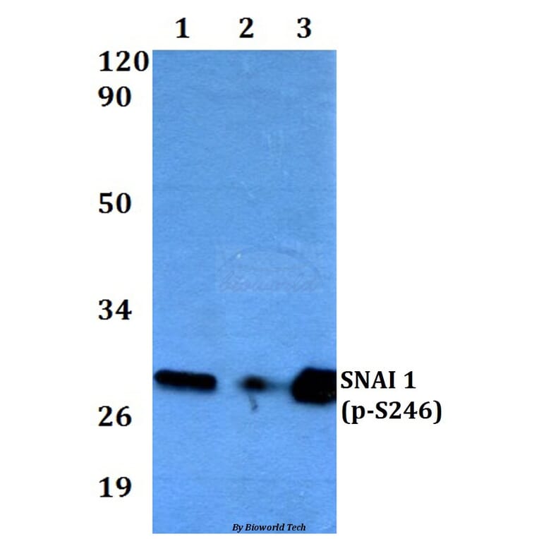 Anti-SNAI 1 (phospho-S246) Antibody from Bioworld Technology (BS4606) - Antibodies.com