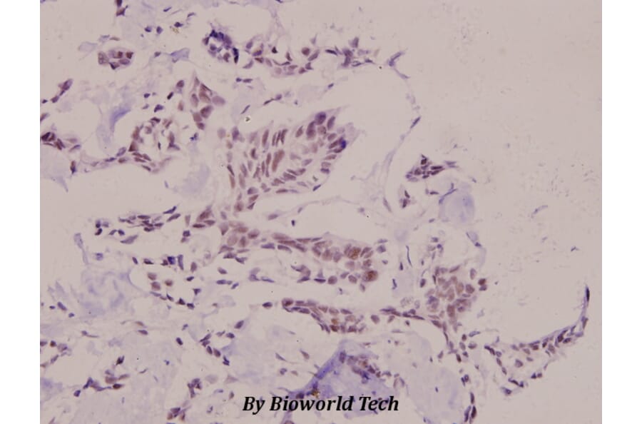 Anti-SNAI 1 (phospho-S246) Antibody from Bioworld Technology (BS4606) - Antibodies.com