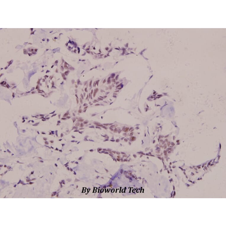 Anti-SNAI 1 (phospho-S246) Antibody from Bioworld Technology (BS4606) - Antibodies.com