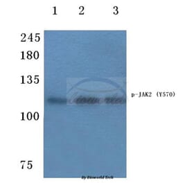 Anti-JAK2 (phospho-Y570) Antibody from Bioworld Technology (BS4610) - Antibodies.com