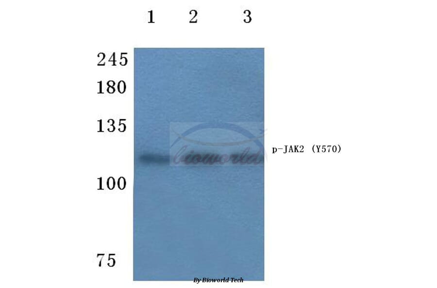 Anti-JAK2 (phospho-Y570) Antibody from Bioworld Technology (BS4610) - Antibodies.com