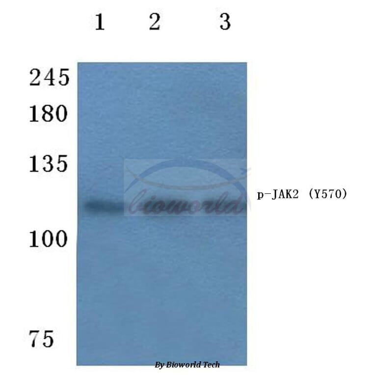 Anti-JAK2 (phospho-Y570) Antibody from Bioworld Technology (BS4610) - Antibodies.com