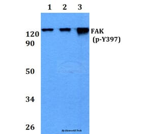 Anti-FAK (phospho-Y397) Antibody from Bioworld Technology (BS4617) - Antibodies.com