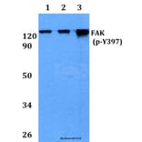 Anti-FAK (phospho-Y397) Antibody from Bioworld Technology (BS4617) - Antibodies.com