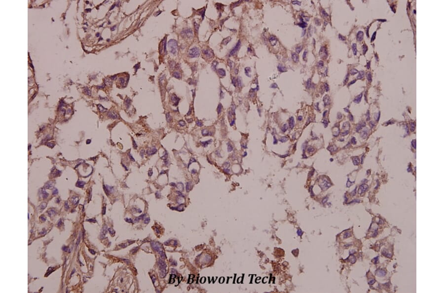 Anti-FAK (phospho-Y397) Antibody from Bioworld Technology (BS4617) - Antibodies.com
