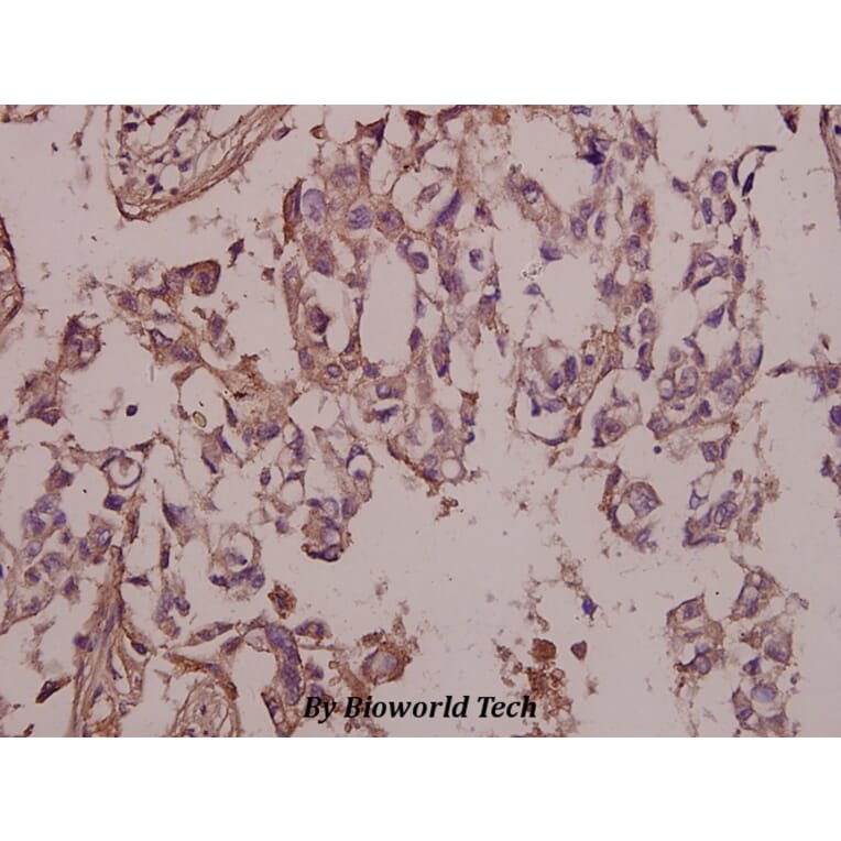 Anti-FAK (phospho-Y397) Antibody from Bioworld Technology (BS4617) - Antibodies.com