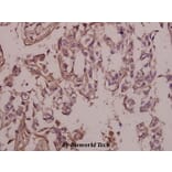 Anti-FAK (phospho-Y397) Antibody from Bioworld Technology (BS4617) - Antibodies.com