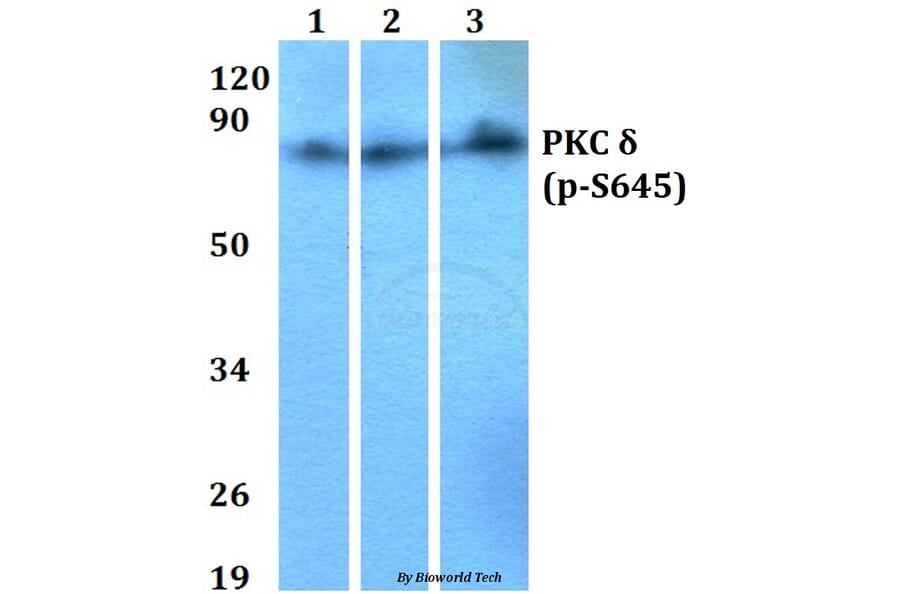 Anti-PKC δ (phospho-S645) Antibody from Bioworld Technology (BS4622) - Antibodies.com