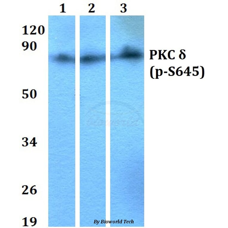 Anti-PKC δ (phospho-S645) Antibody from Bioworld Technology (BS4622) - Antibodies.com