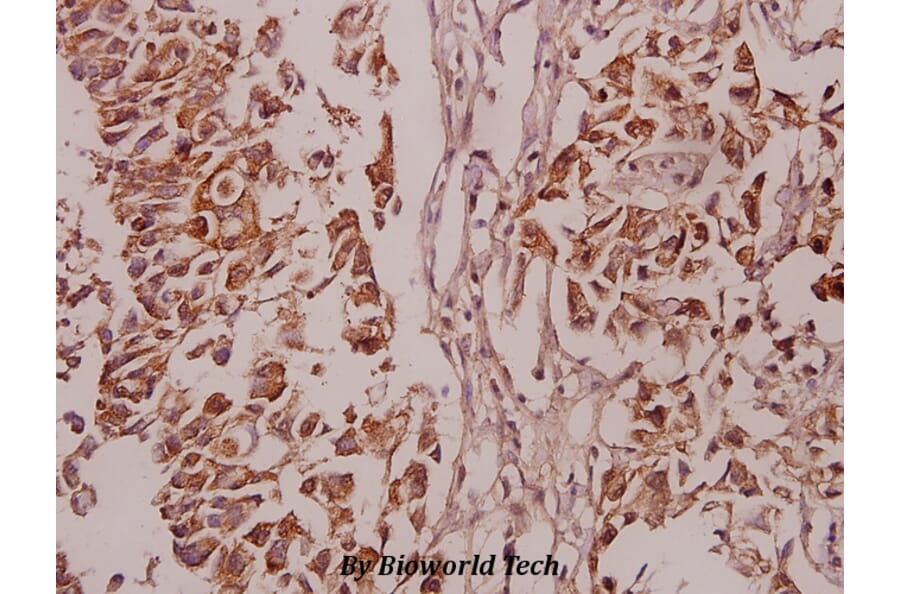 Anti-PKC δ (phospho-S645) Antibody from Bioworld Technology (BS4622) - Antibodies.com
