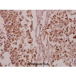 Anti-PKC δ (phospho-S645) Antibody from Bioworld Technology (BS4622) - Antibodies.com