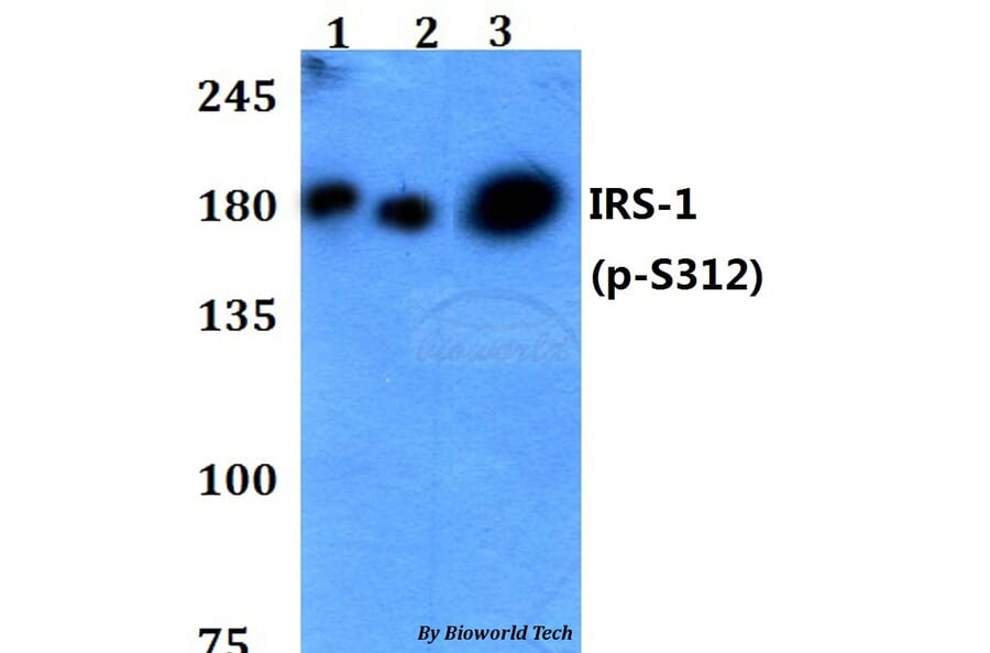 Anti-IRS-1 (phospho-S312) Antibody from Bioworld Technology (BS4633) - Antibodies.com
