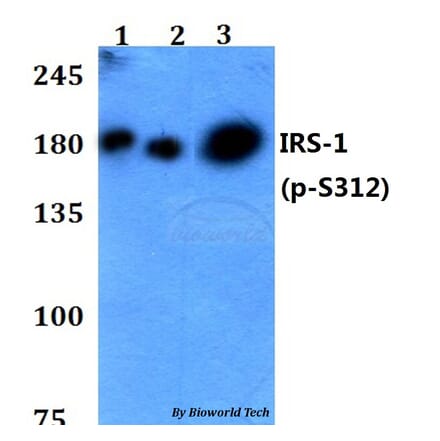 Anti-IRS-1 (phospho-S312) Antibody from Bioworld Technology (BS4633) - Antibodies.com