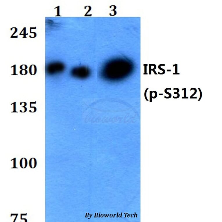 Anti-IRS-1 (phospho-S312) Antibody from Bioworld Technology (BS4633) - Antibodies.com
