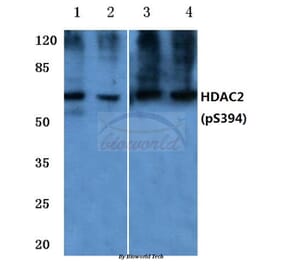 Anti-HDAC2 (phospho-S394) Antibody from Bioworld Technology (BS4637) - Antibodies.com