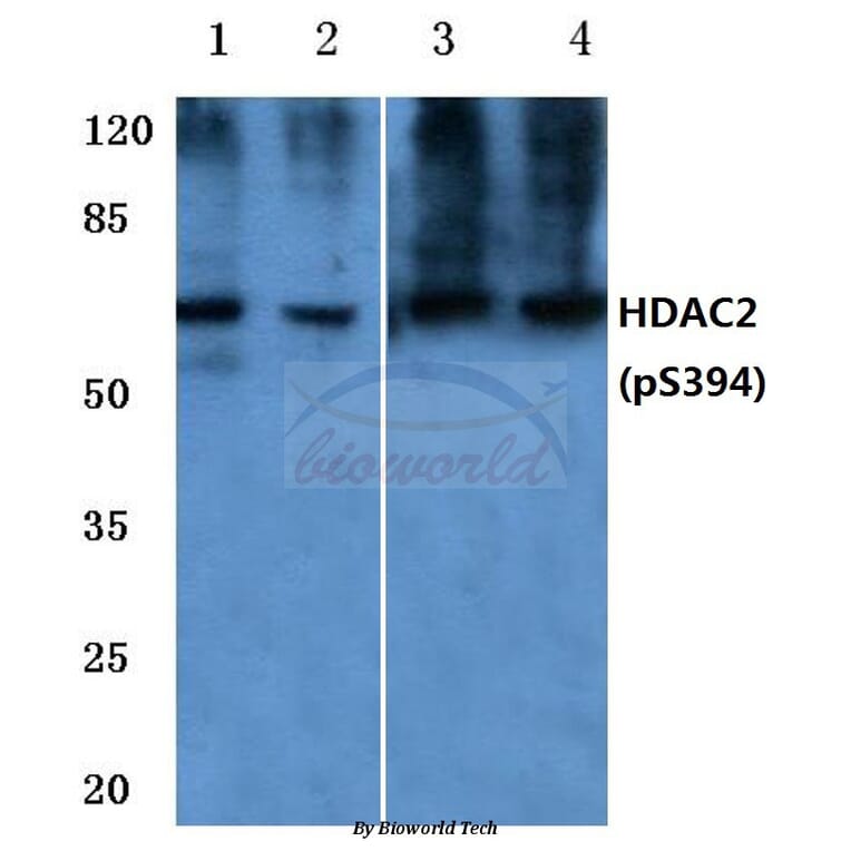 Anti-HDAC2 (phospho-S394) Antibody from Bioworld Technology (BS4637) - Antibodies.com