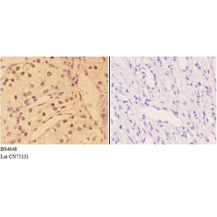 Anti-AKT (phospho-Y315) Antibody from Bioworld Technology (BS4648) - Antibodies.com