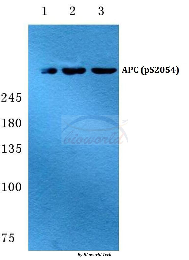 Invitrogen Human ZKSCAN2 (aa 120-190) Control Fragment Recombinant Protein  | Fisher Scientific