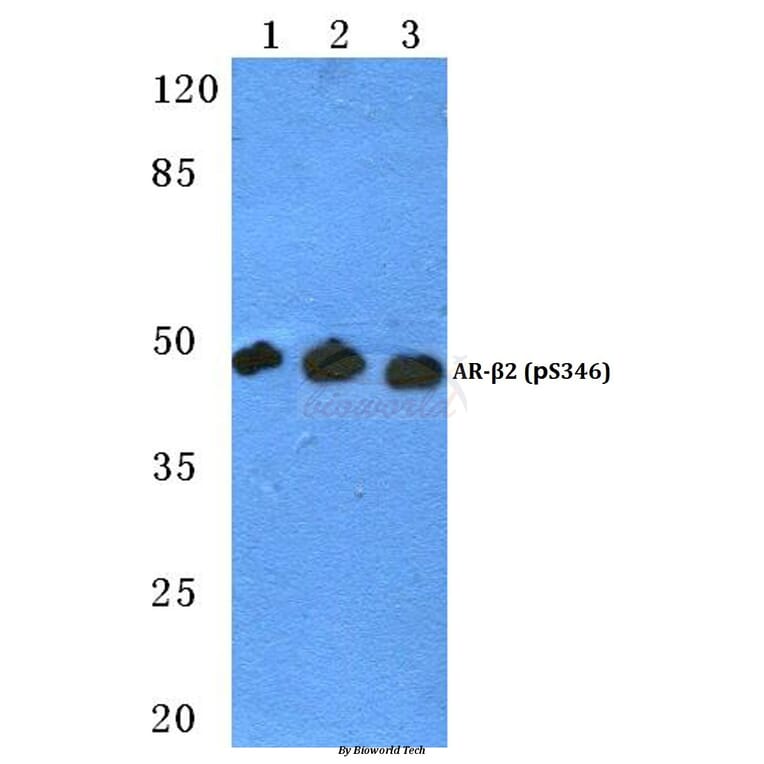 Anti-AR-β2 (phospho-S346) Antibody from Bioworld Technology (BS4652) - Antibodies.com