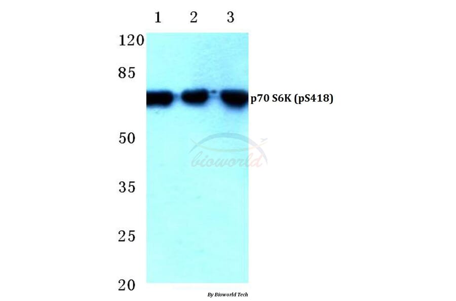 Anti-p70 S6K (phospho-S418) Antibody from Bioworld Technology (BS4653) - Antibodies.com
