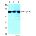 Anti-p70 S6K (phospho-S418) Antibody from Bioworld Technology (BS4653) - Antibodies.com
