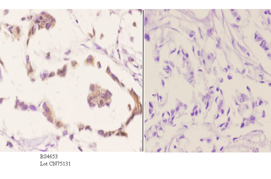 Anti-p70 S6K (phospho-S418) Antibody from Bioworld Technology (BS4653) - Antibodies.com