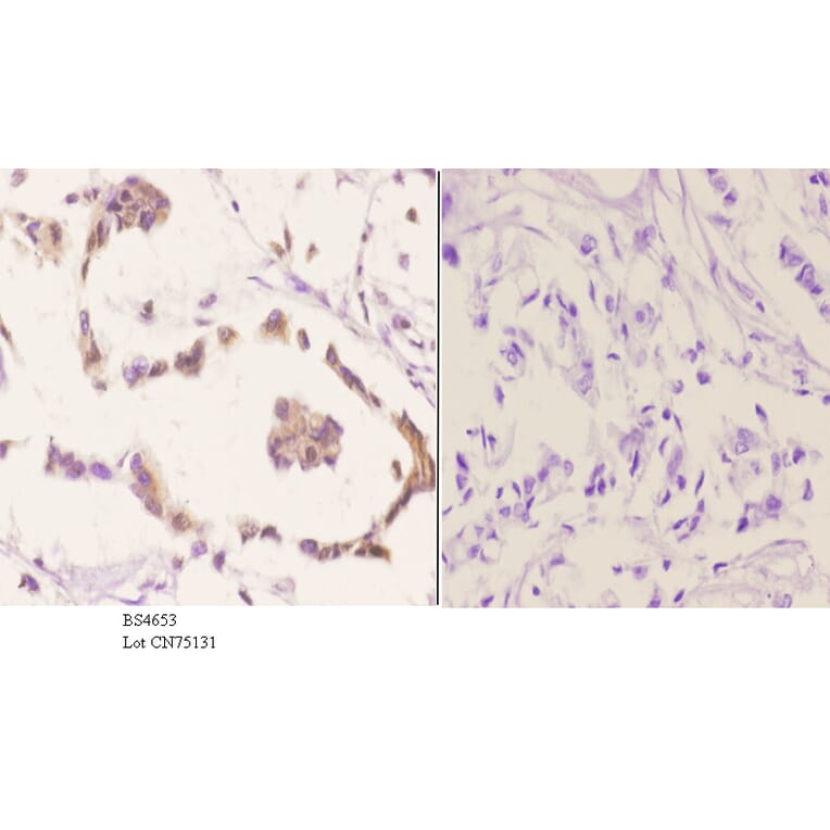Anti-p70 S6K (phospho-S418) Antibody from Bioworld Technology (BS4653) - Antibodies.com