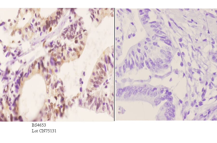 Anti-p70 S6K (phospho-S418) Antibody from Bioworld Technology (BS4653) - Antibodies.com