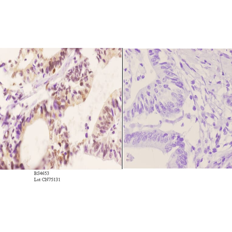 Anti-p70 S6K (phospho-S418) Antibody from Bioworld Technology (BS4653) - Antibodies.com