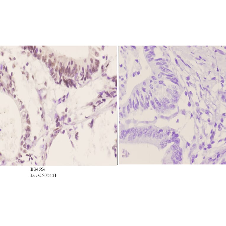 Anti-ATF2 (phospho-S498) Antibody from Bioworld Technology (BS4654) - Antibodies.com