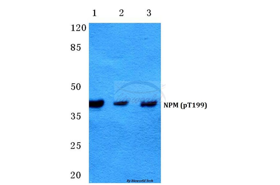 Anti-NPM (phospho-T199) Antibody from Bioworld Technology (BS4655) - Antibodies.com