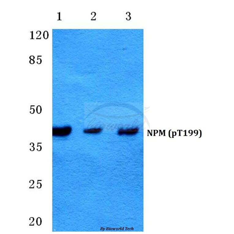 Anti-NPM (phospho-T199) Antibody from Bioworld Technology (BS4655) - Antibodies.com