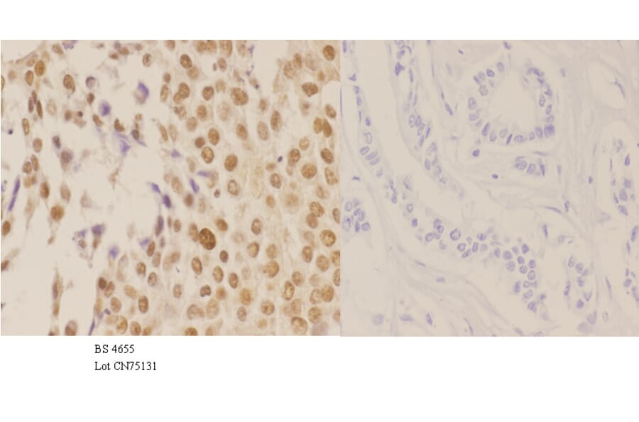 Anti-NPM (phospho-T199) Antibody from Bioworld Technology (BS4655) - Antibodies.com