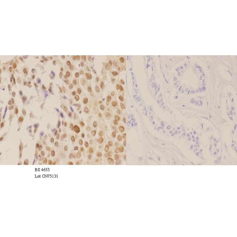 Anti-NPM (phospho-T199) Antibody from Bioworld Technology (BS4655) - Antibodies.com