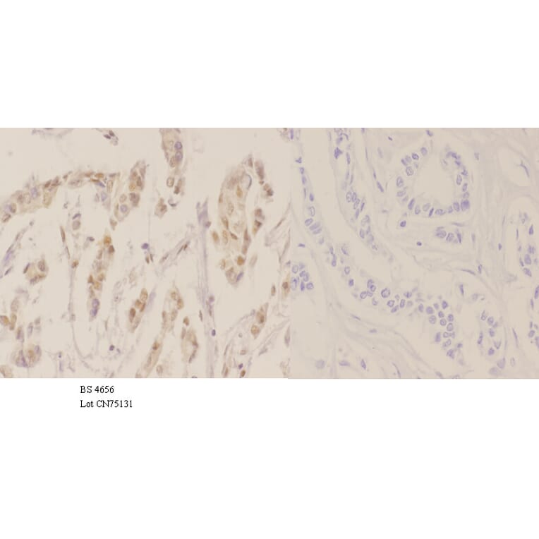 Anti-NPM (phospho-T234) Antibody from Bioworld Technology (BS4656) - Antibodies.com
