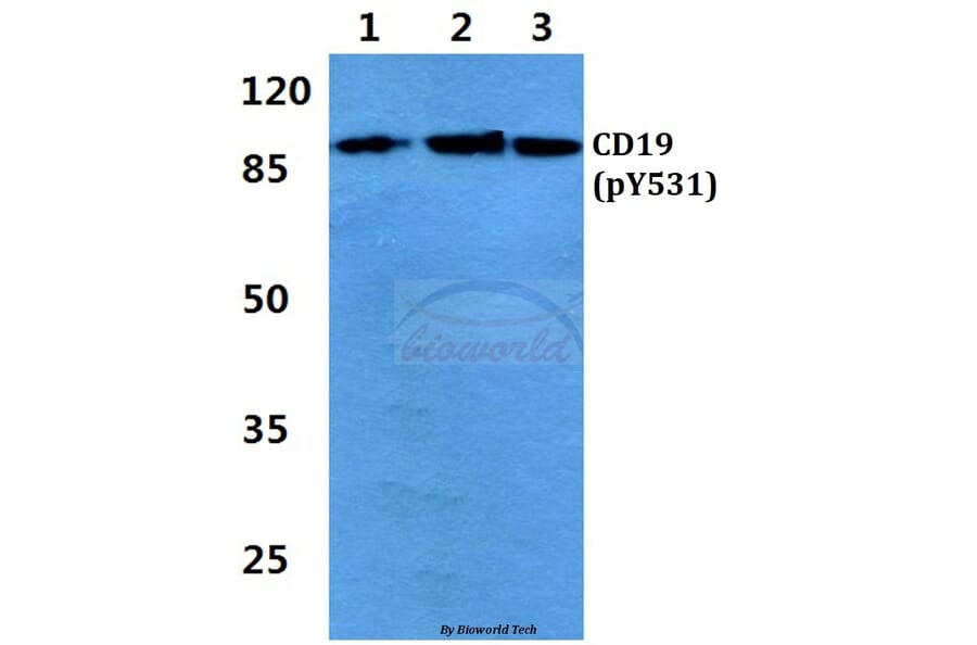 Anti-CD19 (phospho-Y531) Antibody from Bioworld Technology (BS4664) - Antibodies.com